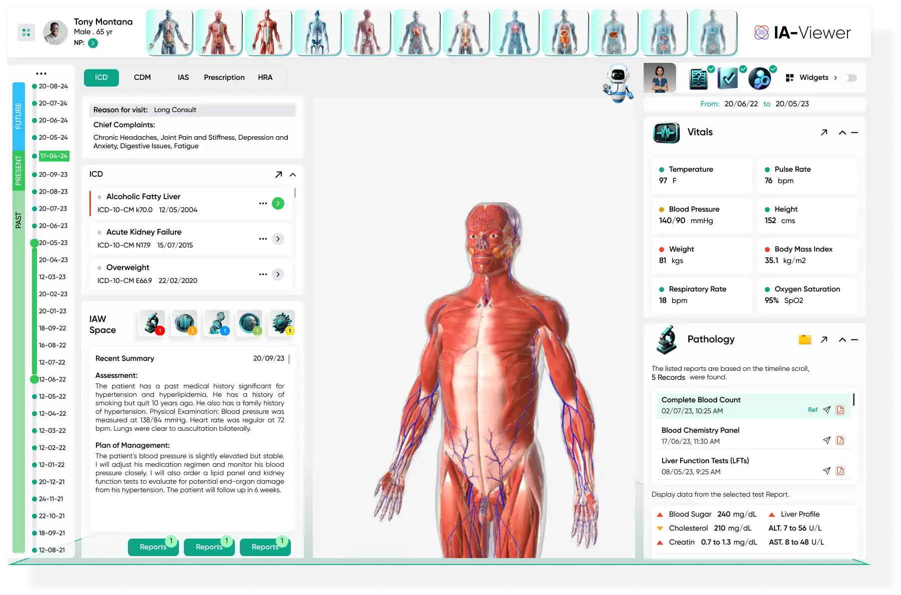 IA-Viewer-ICD View (2)