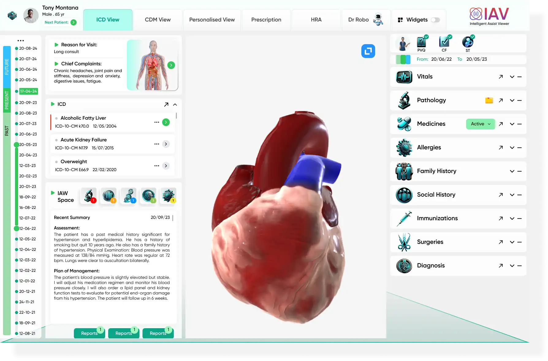 IA-Viewer-ICD View